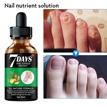7DAYS Nail Fungus Treatment Essence Serum Care Hand and Foot Care Removal Repair Gel Anti-infective 3
