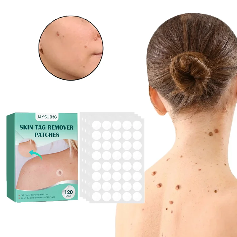 

Warts Remover Patch Skin Tags Pimple Treatments Cream Hydrocolloid Gel Cleaning Foot Corn Plaster Acne Warts Invisible Stickers