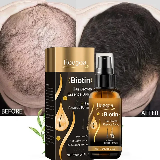 46218-c302fb.jpg Biotin Fast Hair Growth Spray Anti Hair Loss Serum Prevent Baldness Treatment Scalp Beard Beauty Essence Hair Care Products 30ml