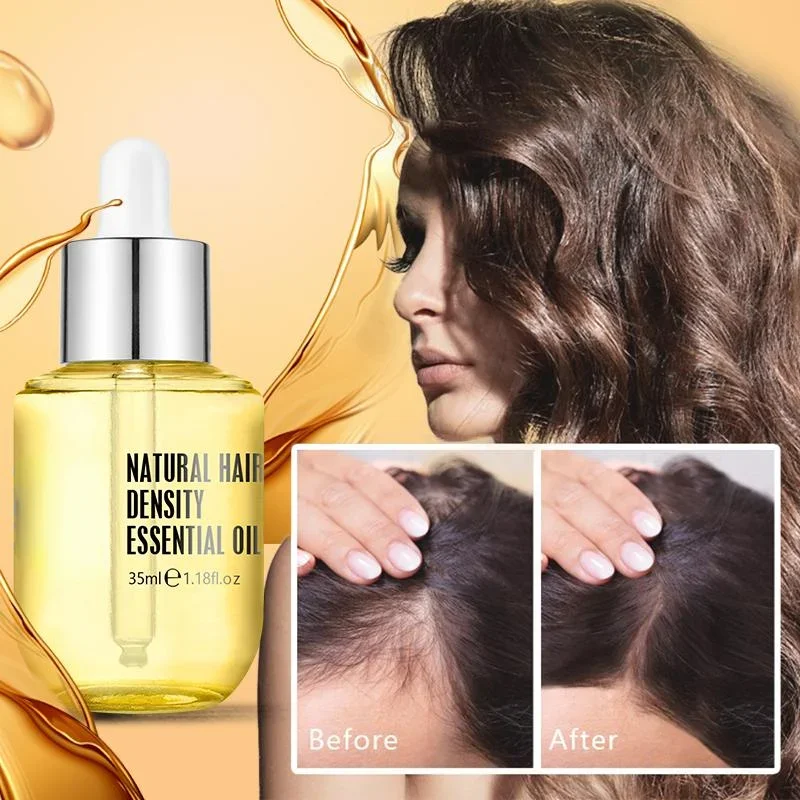 Ginger Essence Hair Growth Products Fast Regrowth Oil Serum Prevent Loss Medicine Care Scalp Treatment Men Women