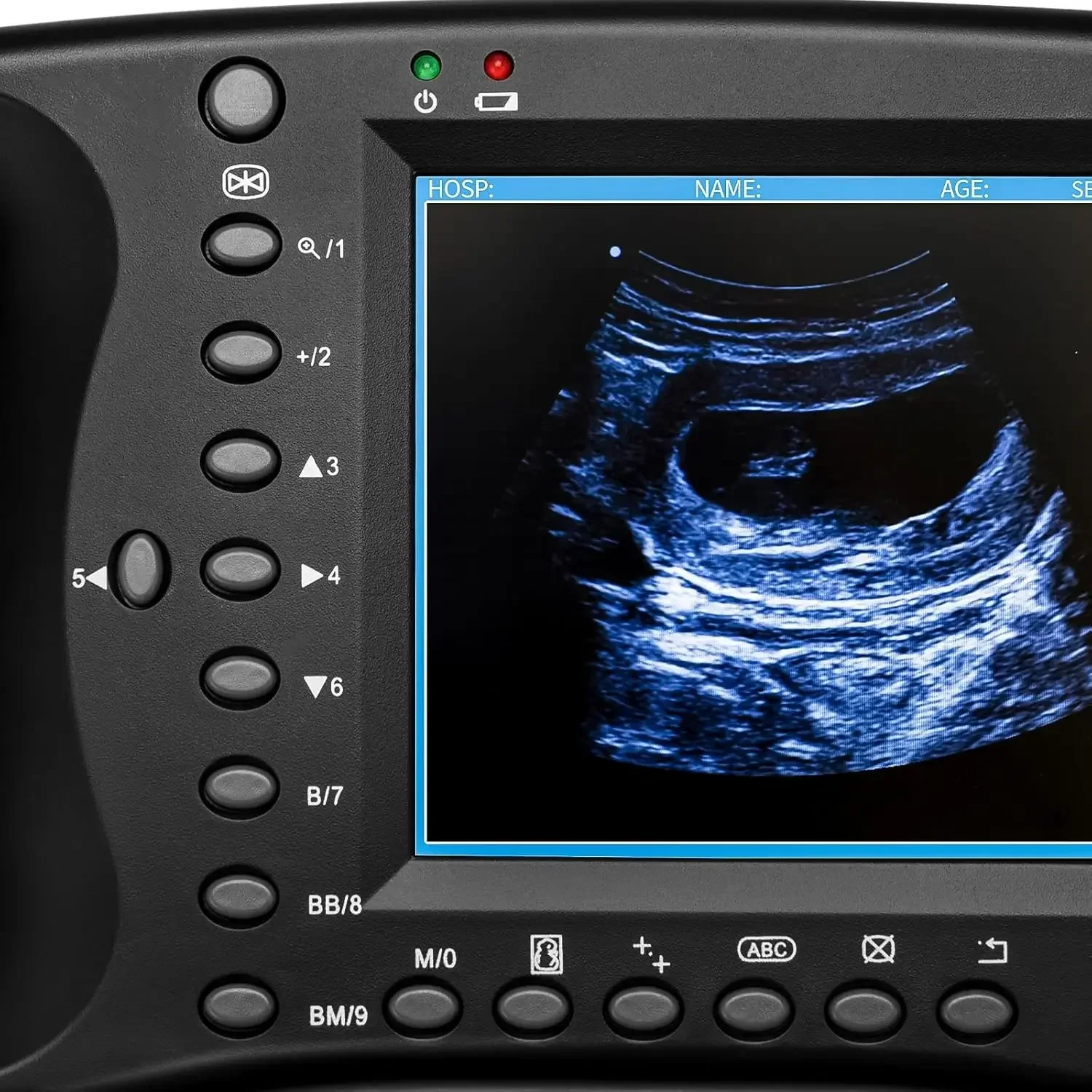 Portable Veterinary Ultrasound Scanner for Pregnancy Dog Sheep Pigs Vet Handheld Scanner with 3.5Mhz Mechanical Probe
