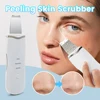 Ultrasonic Peeling Machine Skin Care Blackhead Remover Device Face Cleaning Pore Cleanser Facial Lifting Massager Skin Scrubber 1