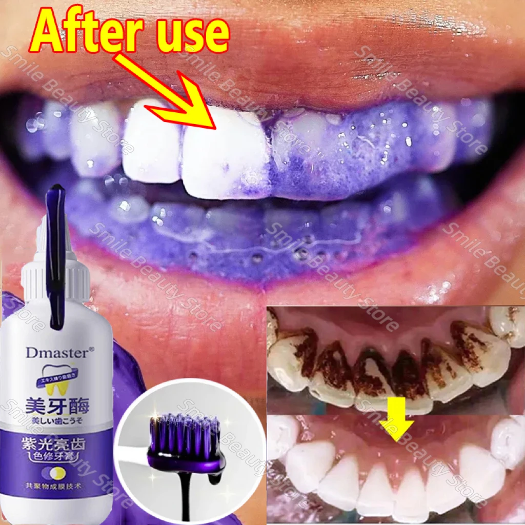 V34 Teeth Whitening Enzyme Toothpaste Remove Plaque Stains Mousse Cleaning Oral Hygiene Dental Tools Fresh Breath teeth whitening essence teeth whitening product