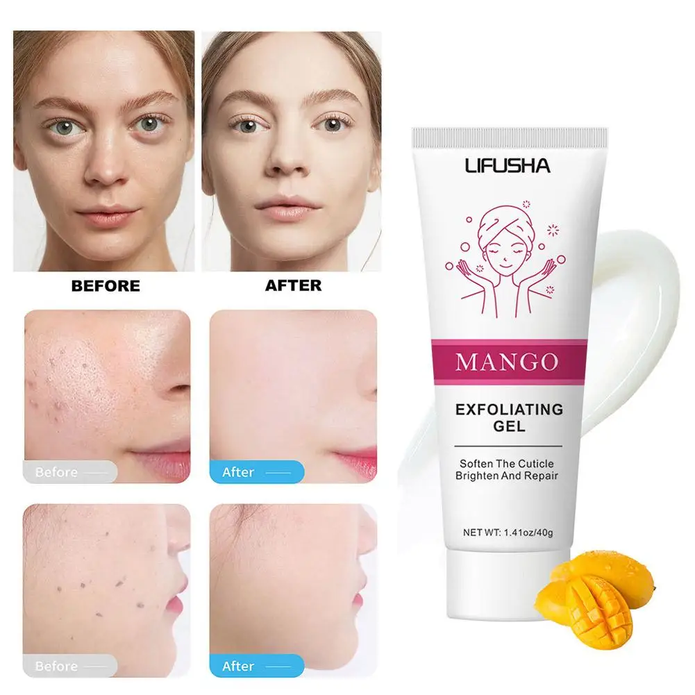 

Mango Exfoliating Gel Cream Facial Scrub Exfoliating Soften Moisturizer Repair Skin Scrub Whitening Cleaner Brighten P6N9