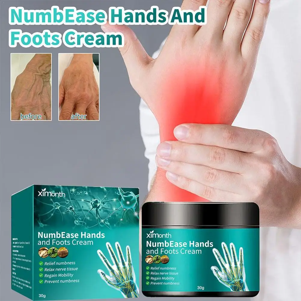 

Numbness health cream of hands and feet cream for face skin care skin whitening cream crema aclaradora de piel cream