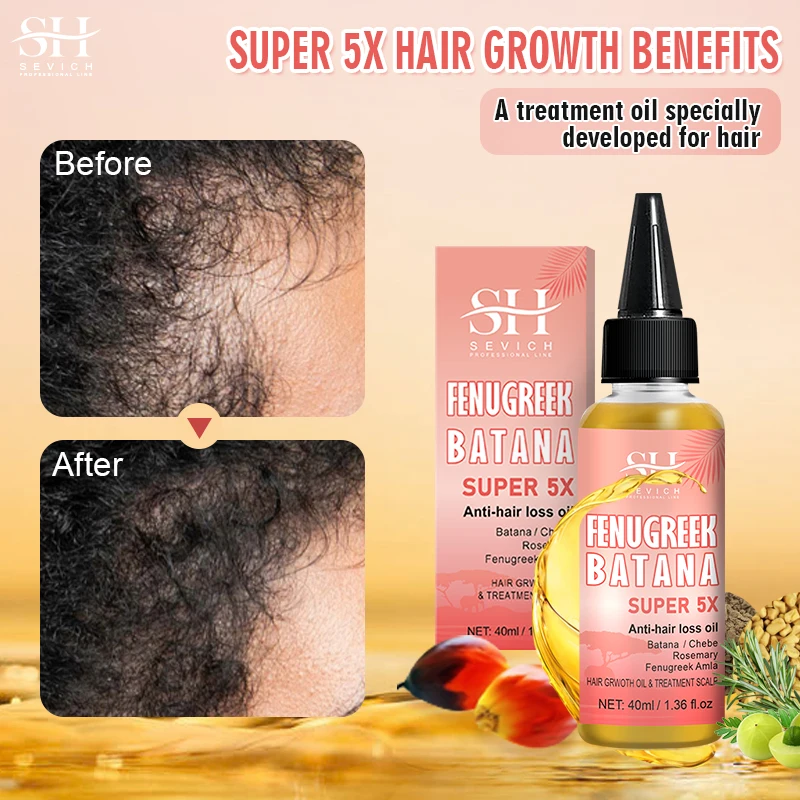 Hot Super 5x Hair Growth Oil Chebe Batana Butter Hair Mask Fenugreek Seeds Fast Anti-Hair Loss Oil Rosemary Hair Regrowth Oils