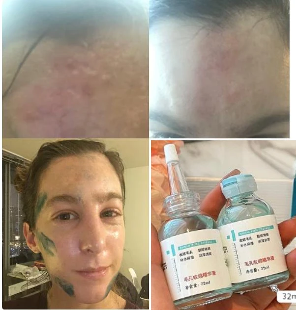 GHKCuCopperPeptideSerumCopperPeptideGHKCuCreamForScar