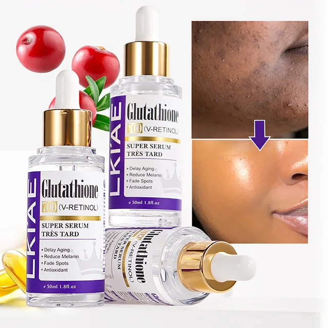LKIAE Sérum visage blanchissant au glutathion, élimine la mélanine, les taches foncées, le cloasma, avec rétinol, la niacinamide, pour tous les types de peau 1