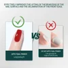 Nail Dehydrator and Primer Acid Free Natural Nail Prep Dehydrate Bond Primer Bonding Polish Soft Nails Tips Gel Nail Supplies 6