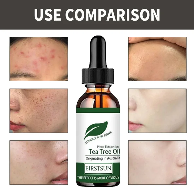 Pure Tea Tree Oil Moisturizer