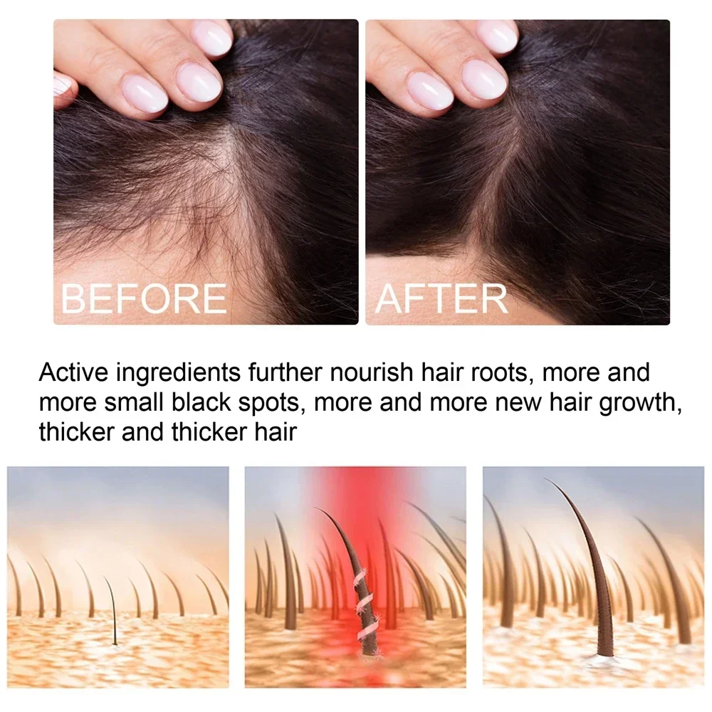 Ginger Hair Growth Sprays Products Fast Grows Nourish Damaged Hair Care Natural Anti Loss Serum Prevent Baldness Treatment