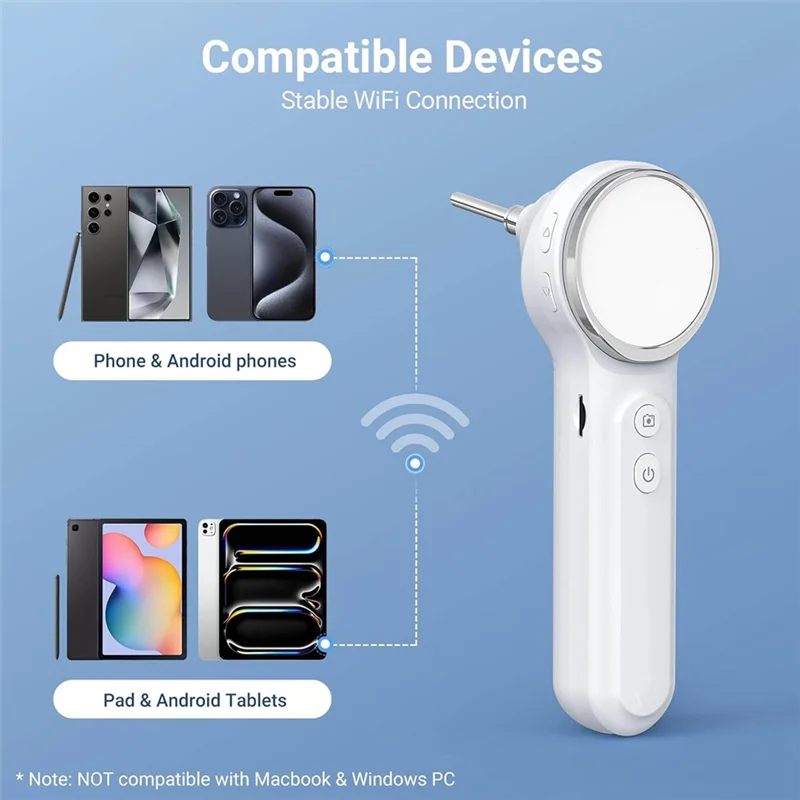 SUNRI-Digital Otoscope With Light, 1.85 In IPS Screen, 720P HD Video Ear Camera, Ear Wax Removal Tool 1