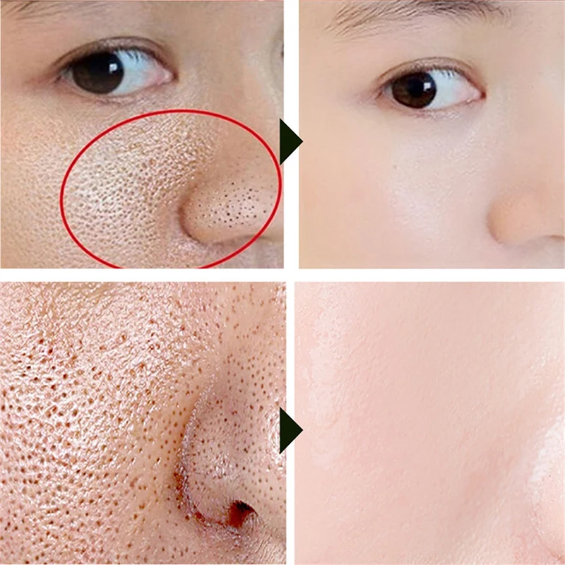 Facial Serum Facial Essence Blue Microneedle Shrink Pores Whitening Lifting Firm Fine Line Moisturise Melanin Remove Skin Care Product