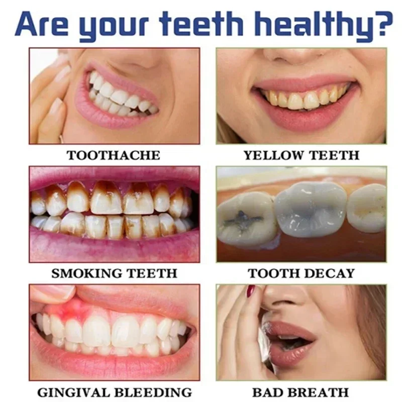 V34 Teeth Whitening Toothpaste 5D Tooth Whiten Strips Oral Hygiene Cleaning Dental Bleaching Tools Fresh Breath Dentistry Care