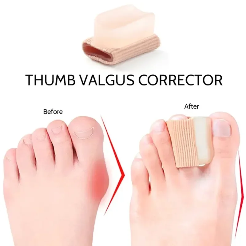 Description Picture 5 of item1PCS Toe Separator Hallux Valgus Bunion Corrector Orthotics Night Foot Care Thumb Daily Big Bone Tool Pedicure Feet Straightener