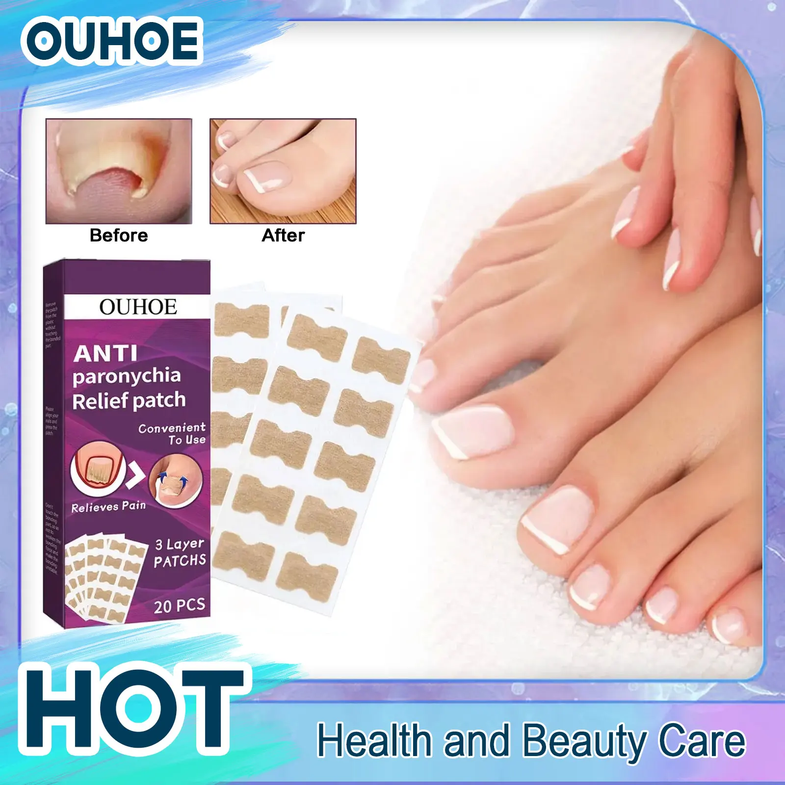 

Paronychia Correction Patch Infection Treatment Fungus Removal Ingrown Toenail Care Repairing Onychomycosis Anti Fungal Stickers