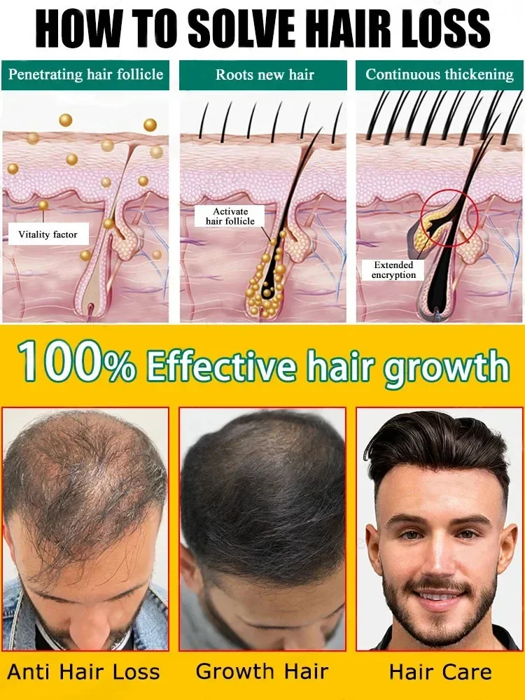 Nick-Hair care beauty, quality of damaged hair, strengthening of the complexion and improvement losses