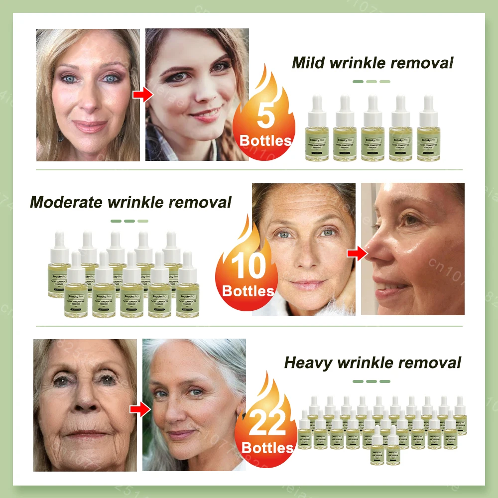 Facial Neck Hand Feet Anti-wrinkle Wrinkle Removal Essence Anti aging Serum Skin Care Lift Tighten Reduce Fine Lines Moisturize