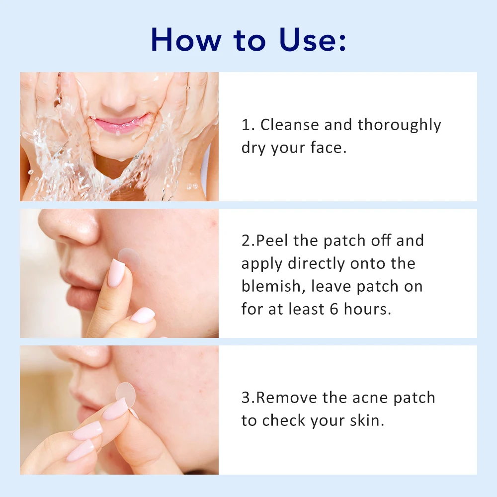 180pcs Invisible Acne Patches Pimple Removal Patches Hydrocolloid  for All Skin Types Face Zit Blemish Spot Treatment Stickers