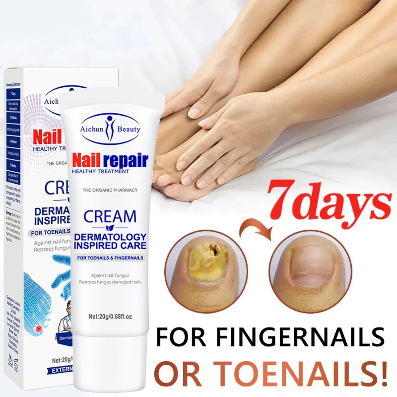 

7 Day Repair Grey Nails Repair Cream Anti-Infection Nail Fungus Barb Thickening Toenail Care Thickening Grey Nails Beauty Nail