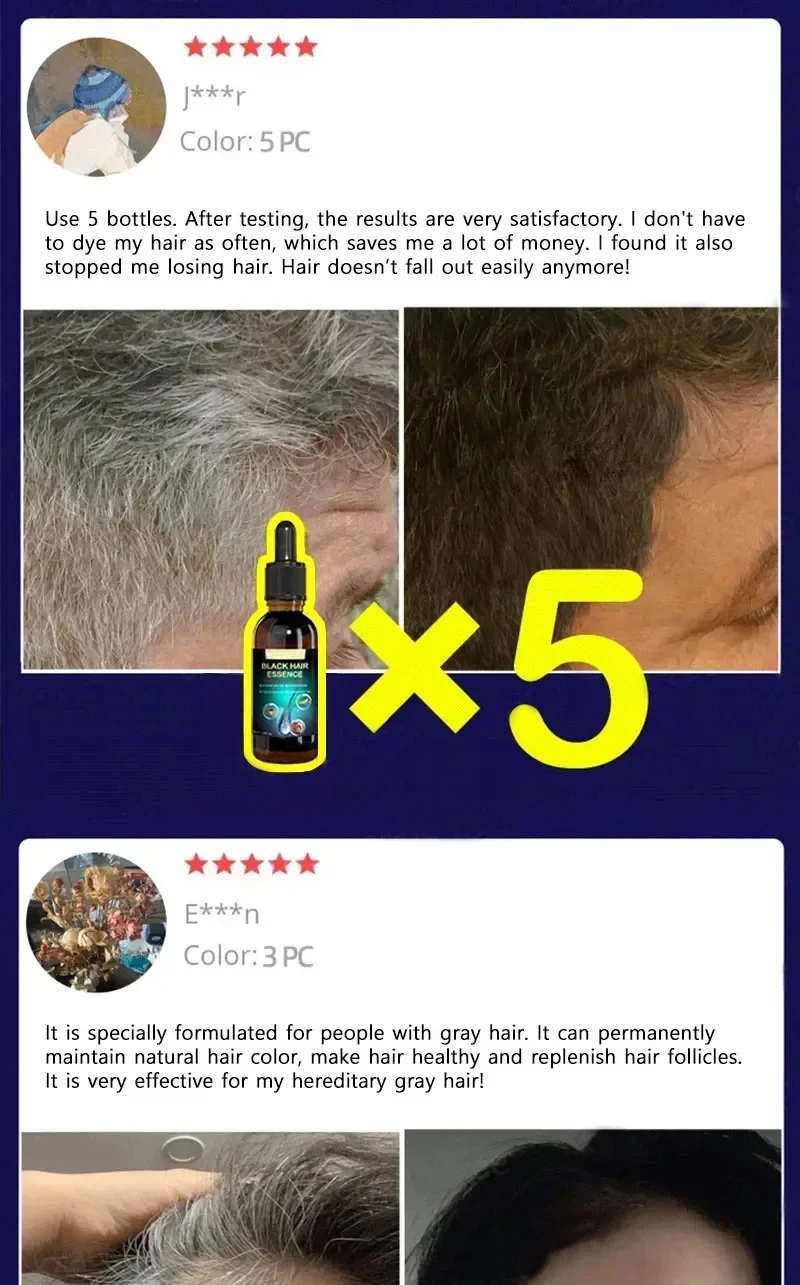 Description Picture 5 of itemAnti-grey hair essence Serum treatment restore natural hair color and restore healthy White To Black hair