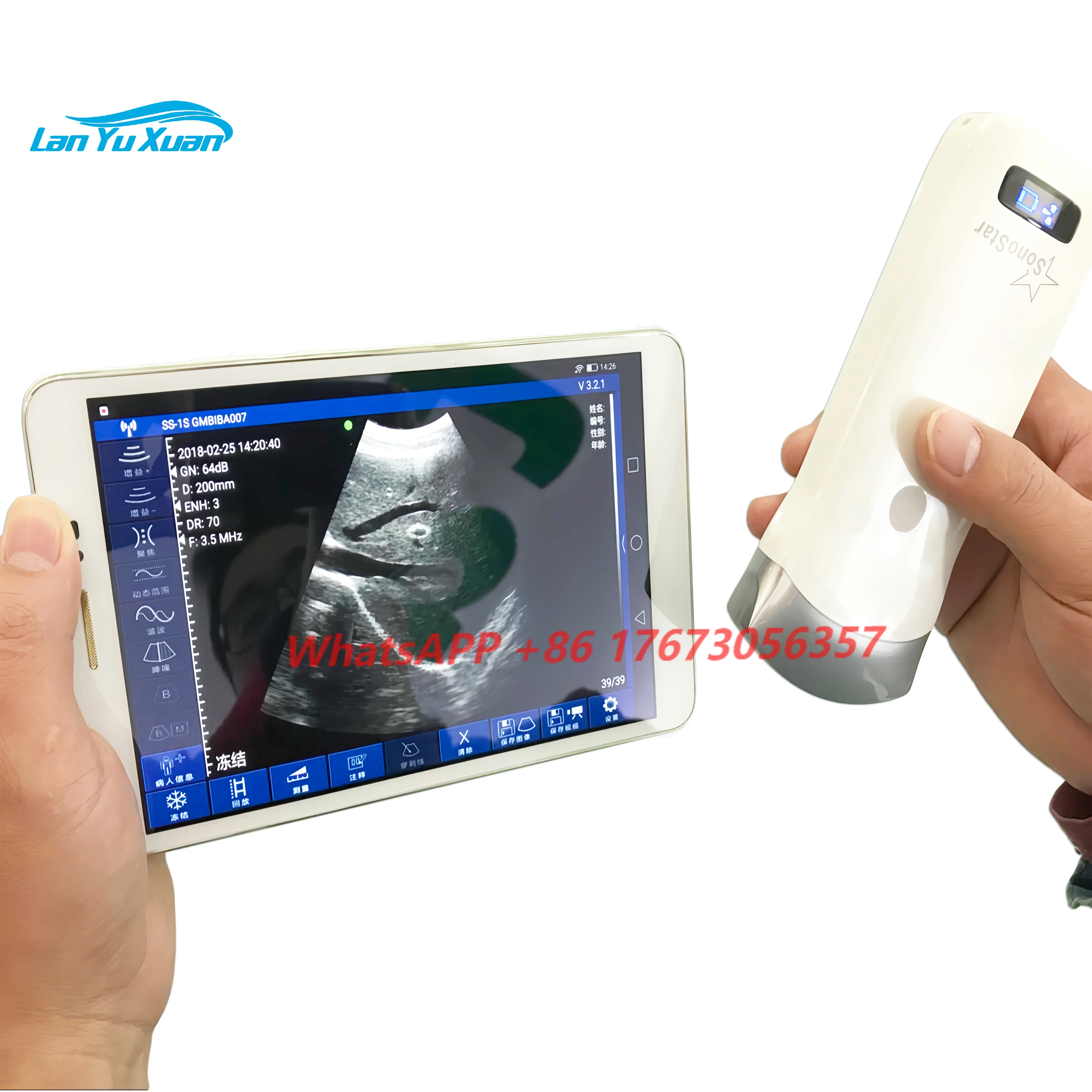

3 In 1 Medical Electronic Convex Array Scanning Phone Tablet Computer IOS Android Windows Wireless Ultrasound Probe Scanner