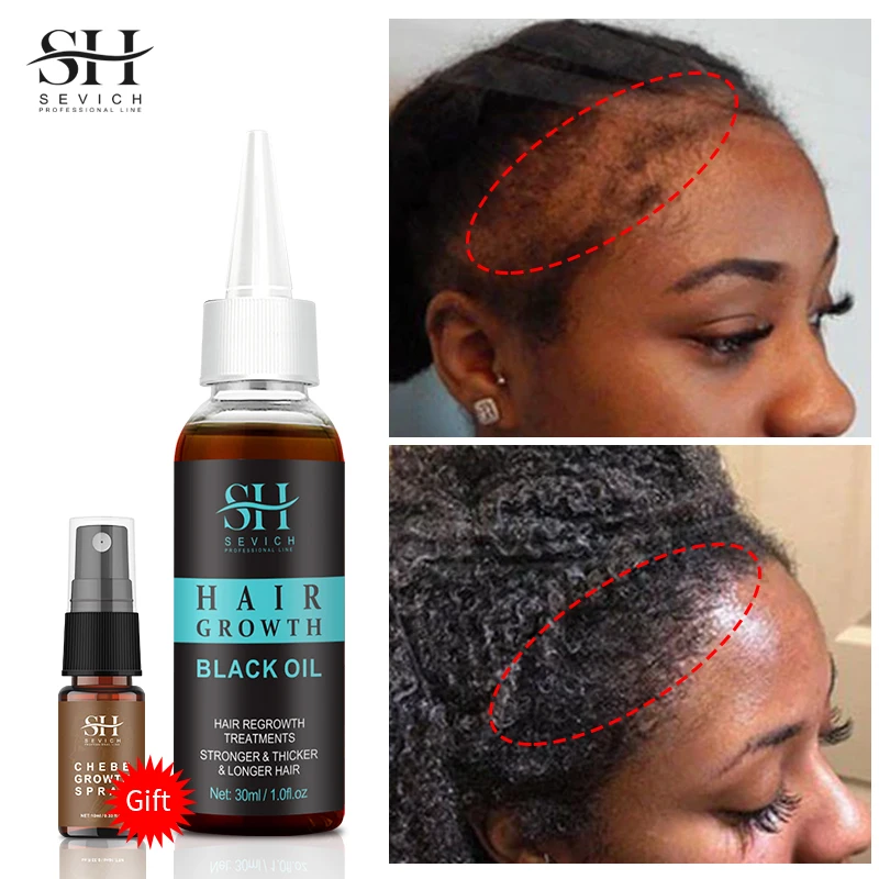 HairGrowthEssenceblackOilforBlackWomenEssentialOilsRepairs