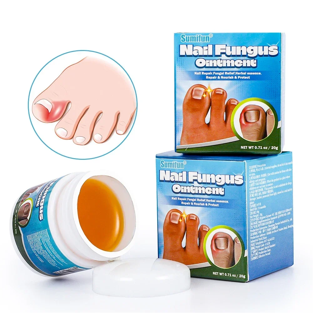 Nail Fungus Remover Treatment Cream Anti Infection Onychomycosis Paronychia Repair Gel Toe Nail Fungal Removal Hand Foot Care Products
