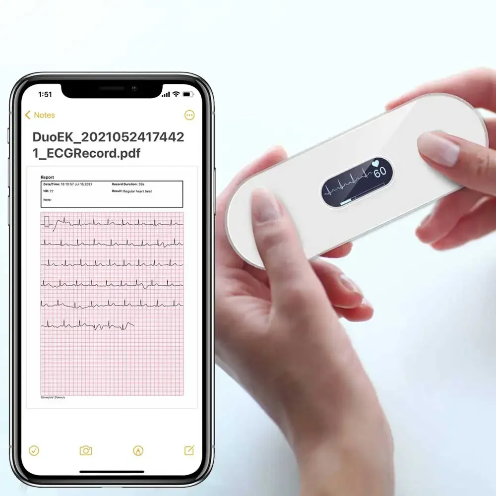 Bluetooth ECG Monitor With OLED EKG AI AnalysiArrhythmias Holter Heart Health Monitor Screen Show Real-time EKG