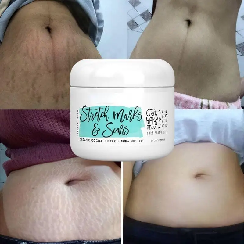 

Natural Organic Postpartum Stretch Mark Removal Skin Repair Cream Body Pregnancy Scar Cream For Women