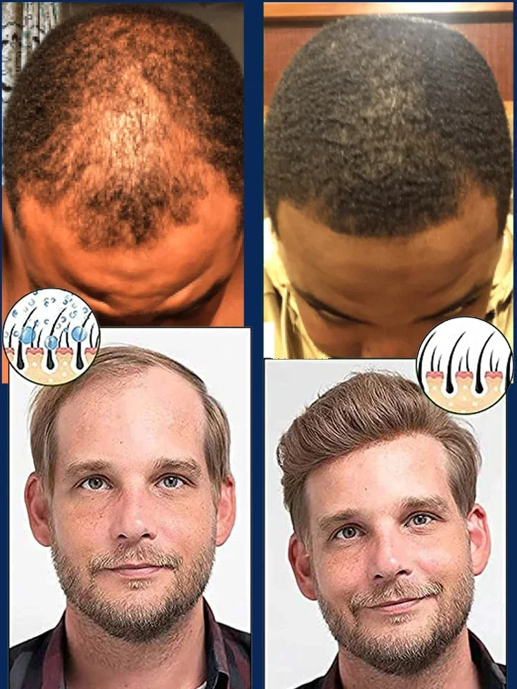 Рисунок 4 - Быстрорастущее масло для роста волос