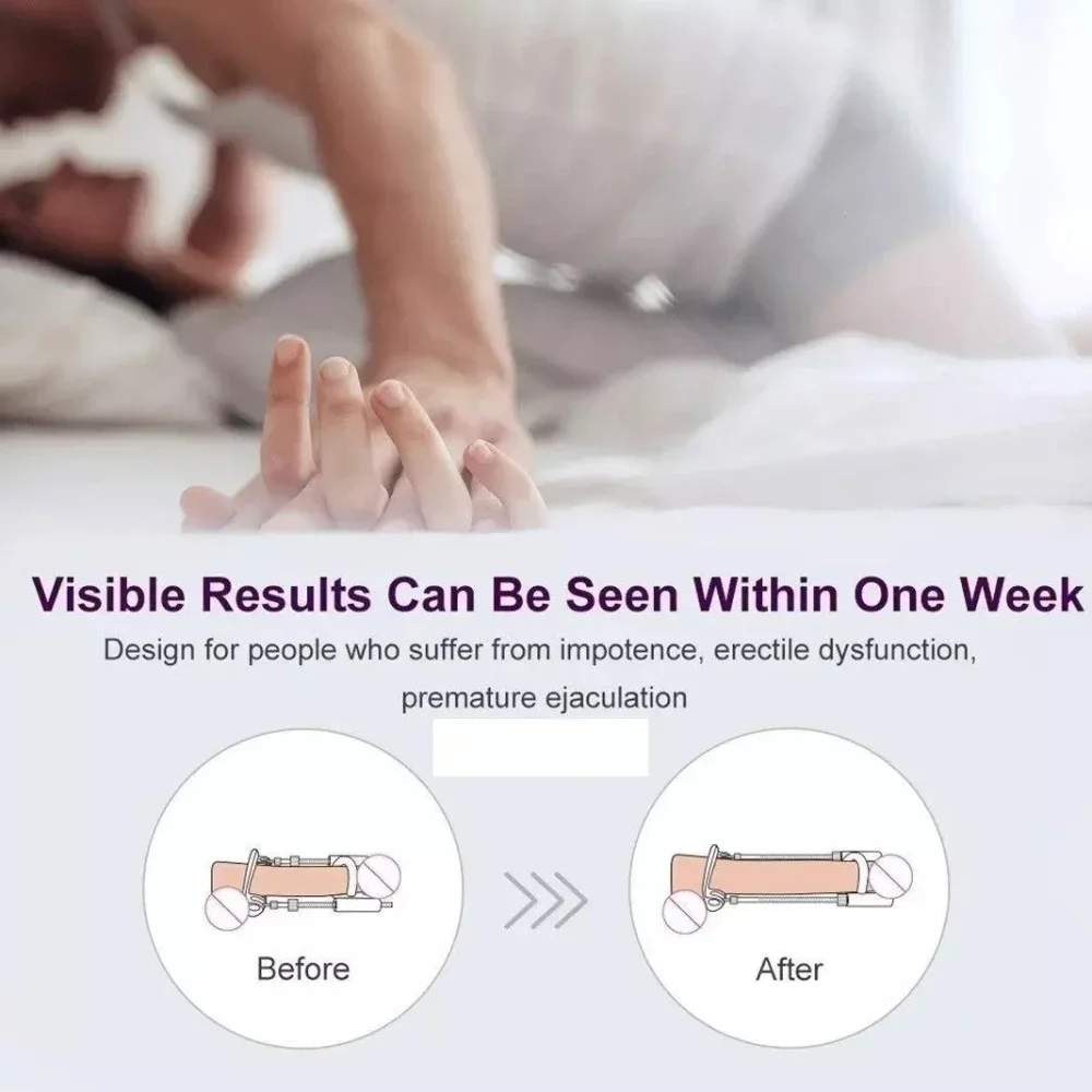 Penis Enlargement Stretch Clamp Extender Penis Stretching Exerciser Penisgrowth Traction Device for Men Portable Sport Train male sex toys