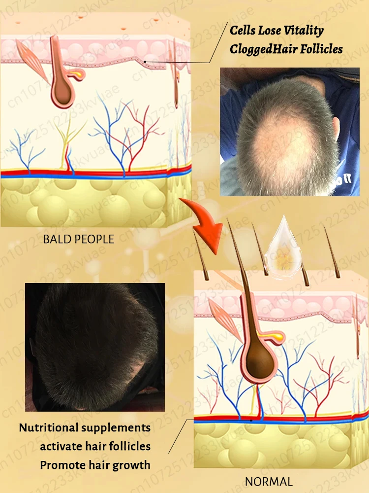 100% Natural Vegetable-based Hair Growth Essential Oil 3-day Hair Growth