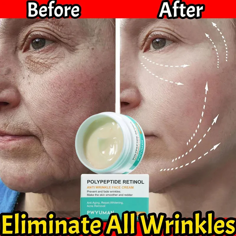 

Retinol Wrinkle Removal Cream Face Anti-Aging Removing Wrinkles Fine Lines Nasolabial Folds Expression Lines Tighten Beauty Care