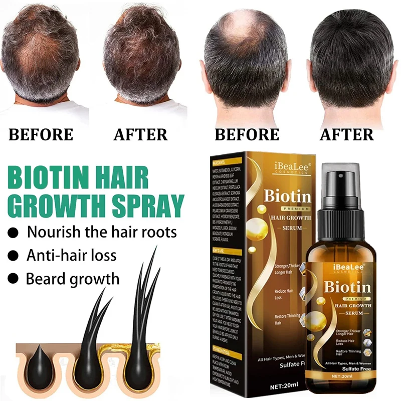

New Hair Growth Oil Fast Hair Care Prevent Hair Loss Scalp Treatment for Men Women Hair Growth Products Beauty Hair Care