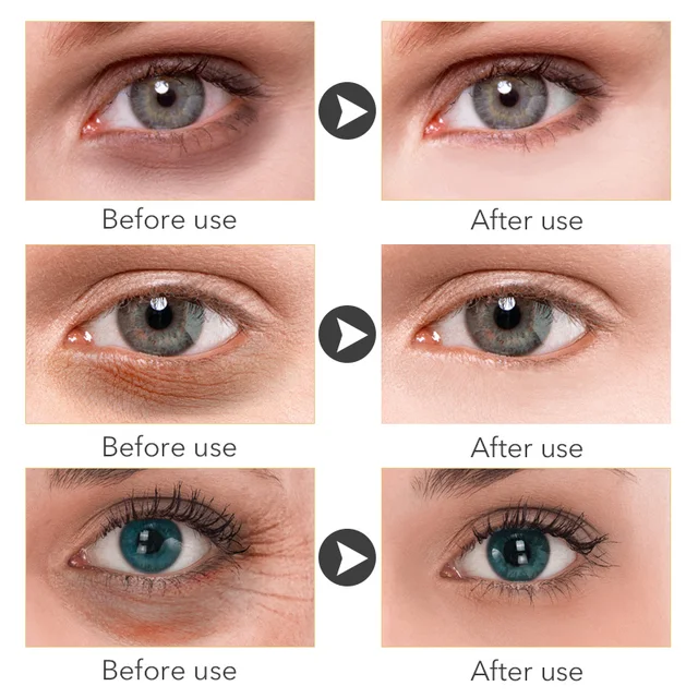 Peptide Anti-Wrinkle Eye Cream Collagen Anti Dark Circle Anti-aging Gel Hyaluronic Acid Anti-Puffiness Eye Bags Korea Cosmetics 4