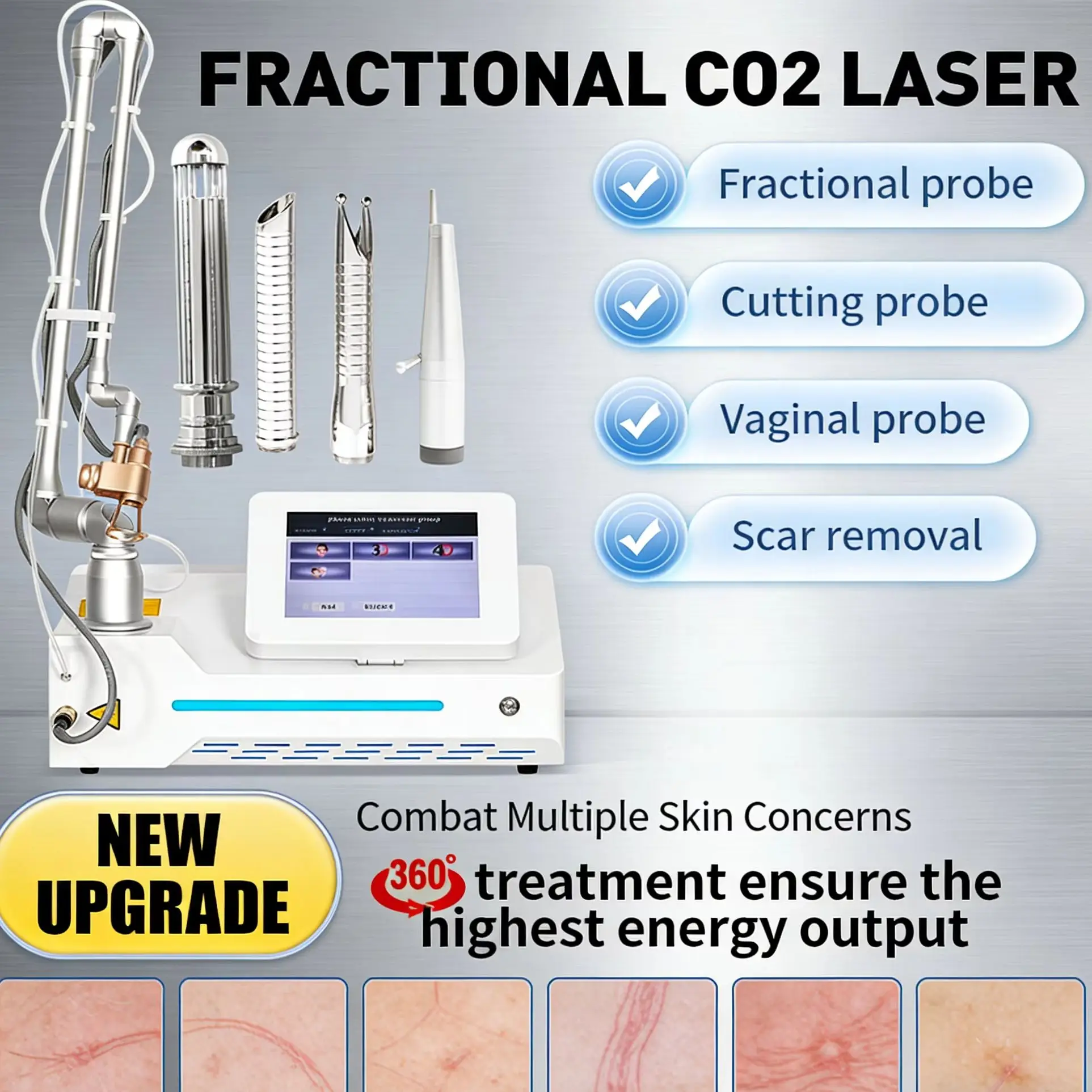 Máquina de Láser Fraccional de CO2 Profesional Portátil de 60W de Alta Potencia para Rejuvenecimiento de la Piel, Mejora de Estrías y Cuidado de Cicatrices