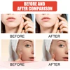 144pcs/set Face Skin Care Acne Pimple Patch 2 Sizes Invisible Professional Healing Absorbing Spot Sticker Covering for Men Women 6