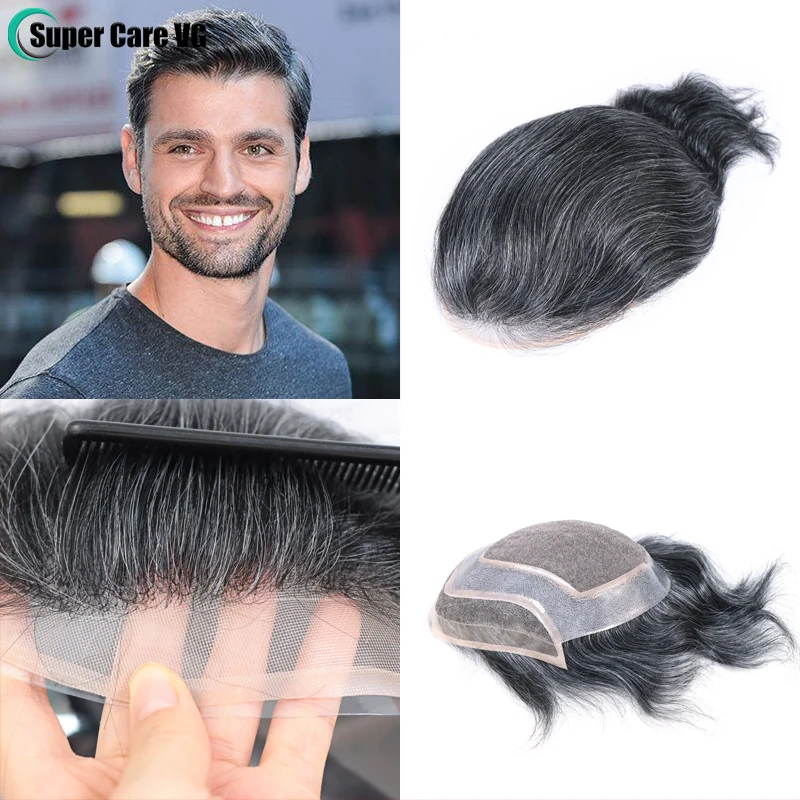 Top 141+ best hair patch in india super hot tnbvietnam.edu.vn