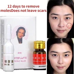 Potion To Remove Dark Spots Scars Acne Freckle Skin Whitening Skin Care Facial Moisturizing Skin Whitening Skin Lightening Cream