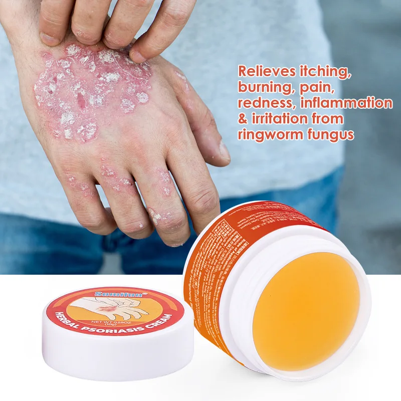Psoriasis Cream Dermatitis Eczematoid Ointment Antibacterial Anti Itching Rash Urticaria Plaster Skin Care Cream medical 10g