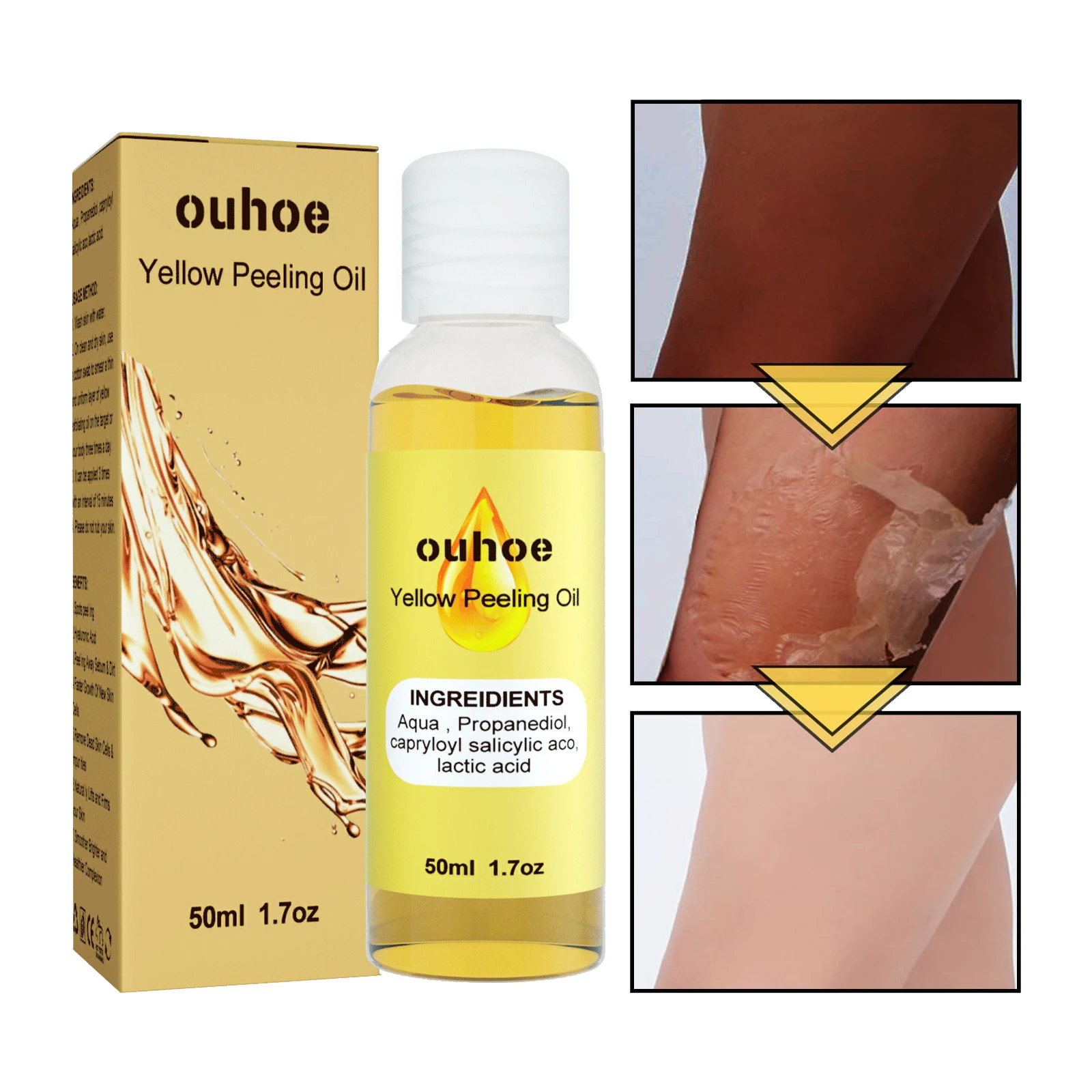 Yellow Peeling Oil Bleaching Dark Skin Spots Remove Elbows Knee Hands Melanin Brightening Exfoliating Whiten Moisturize Body