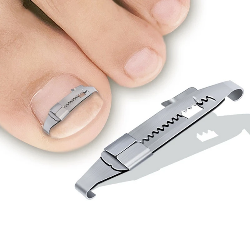 

Carbon steel Ingrown Toenail Pedicure Tool Straightening Correction Clip Curved Brace Toenails Thick Paronychia Correction E0BD