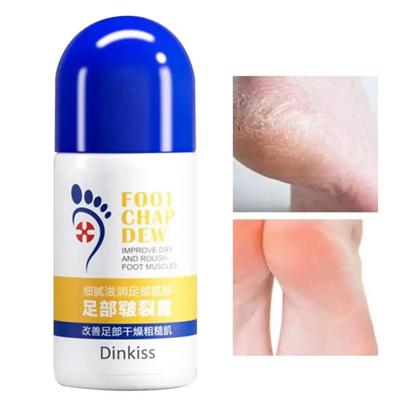 

Feet Moisturizer For Cracked Feet 50g Moisturizing Heel Lotion For Dry Skin Skin Care Product Gift For Teacher Mother Friends