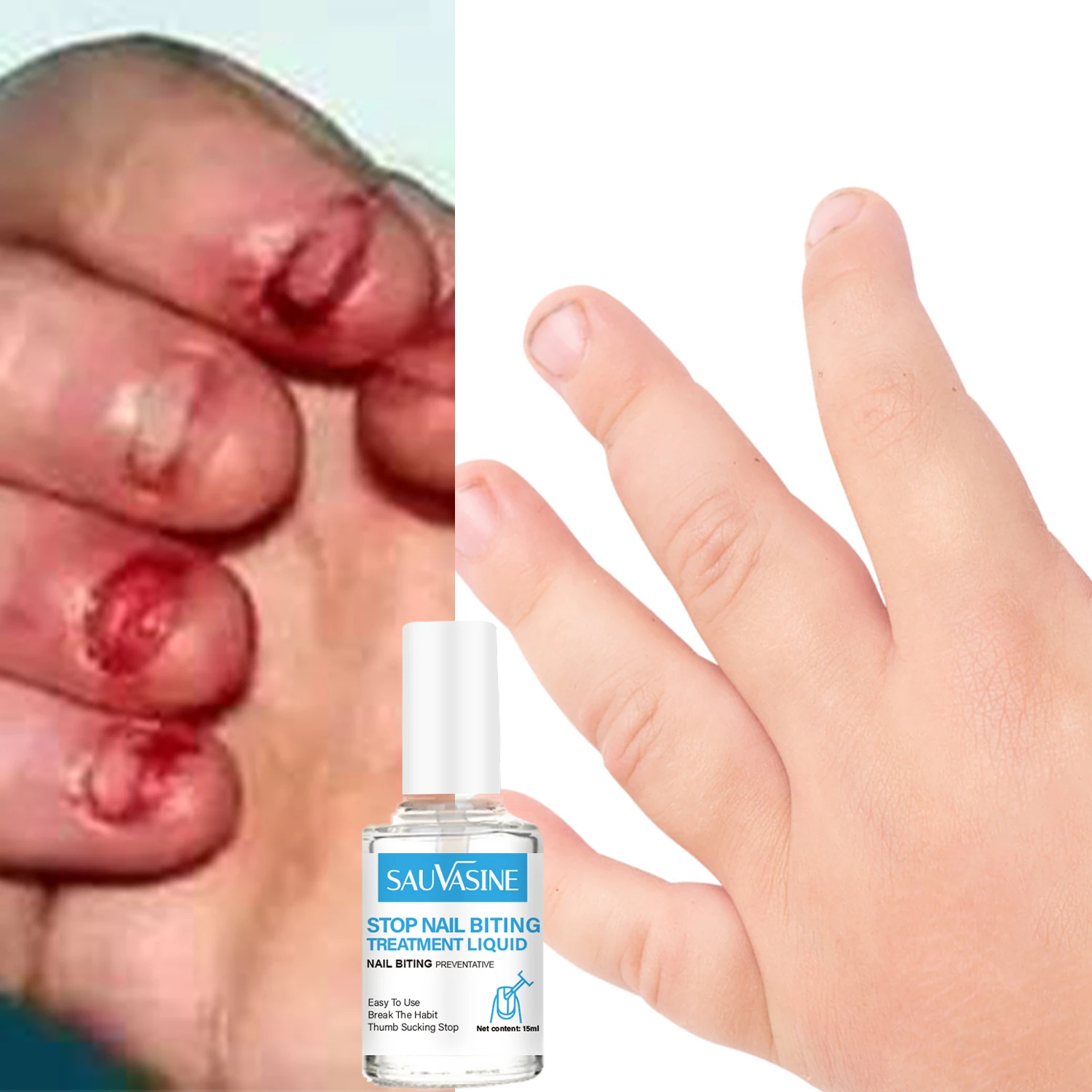 New Children's Non-toxic Anti-biting Nails No Bite Stop Nail Cuticle Biting  Polish Best Child Unisex Not Eating Fingernails - Nail Treatments -  AliExpress