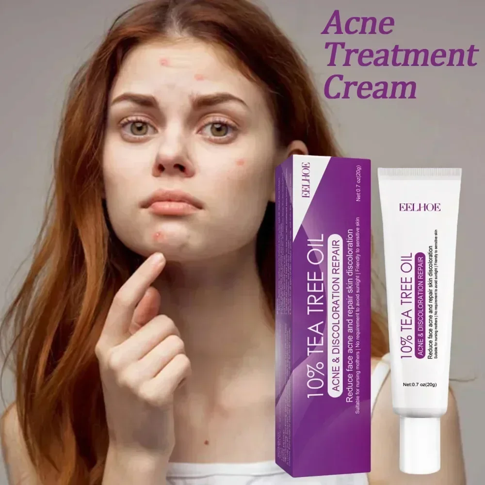 

Tea Tree Acne Treatment Cream Pore Shrink Oil Control Whitening Repair Pimple Deep Cleaning Anti-acne Moisturizer Face Skin Care