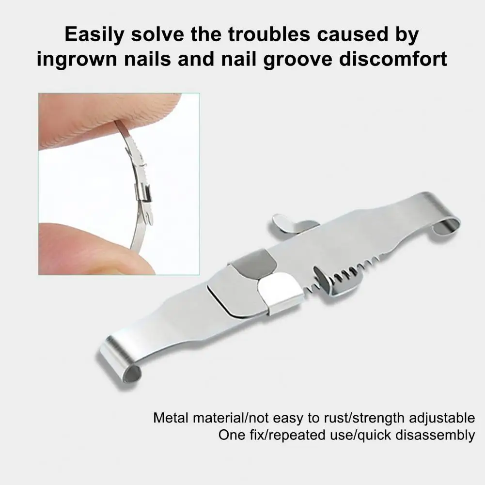 Versatile Reusable Ingrown Toenail Corrector Easy to Use Professional Ingrown Toe Nail Correction Adjuster Buckle
