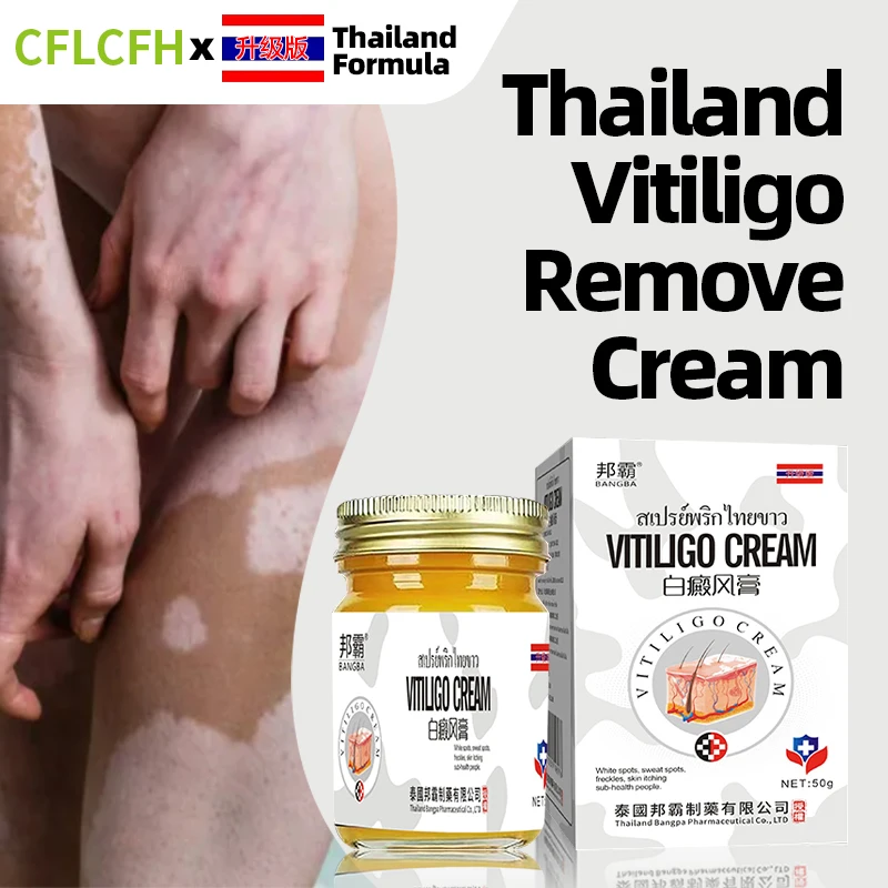 

Крем для ухода за кожей Vitiligo, средство для удаления белых пятен, медицина, средство для восстановления, удаления лейкоплакии ног, Таиланд, формула