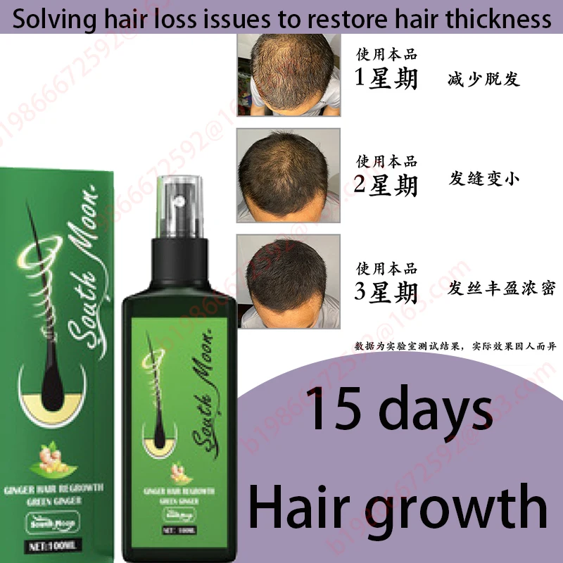 

Fast hair growth promoter products Hair loss Hereditary Seborrheic alopecia treatment oil For Hair growth essence Natural safety