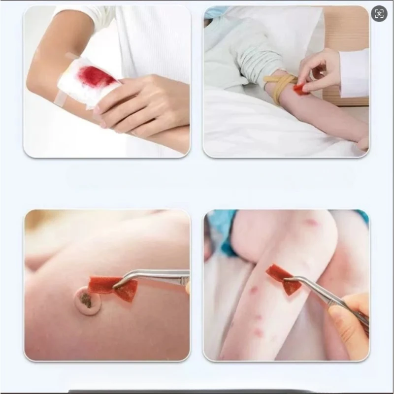 Skin iodine wound disinfection treatment, convenient to carry outdoor sports disaster essential first aid kit supplies